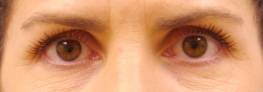 Before  » Click to zoom ->